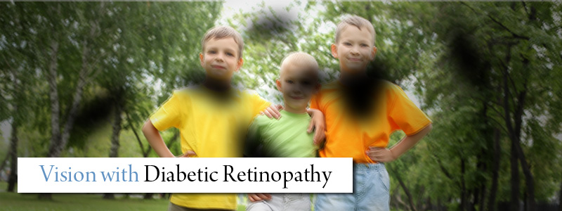 Diabetic Retinopathy | Lipstock LASIK & Cataract Center | Eye Care Richmond